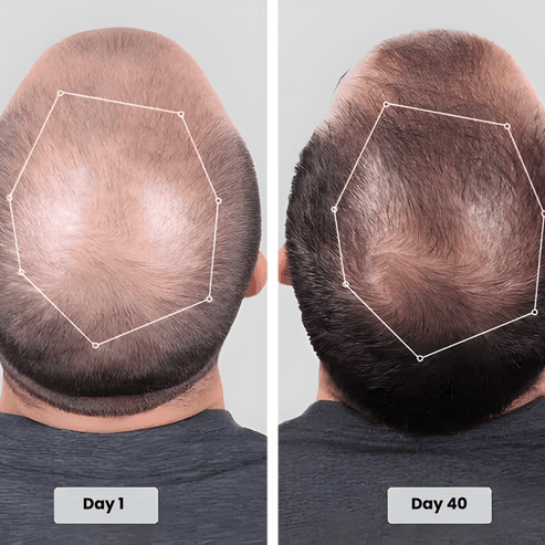 Before after 1