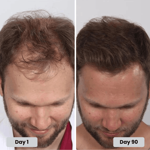 Before after 2
